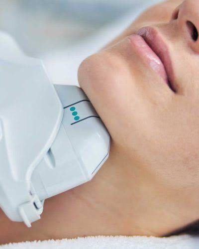 HIFU Ultraschall-Lifting